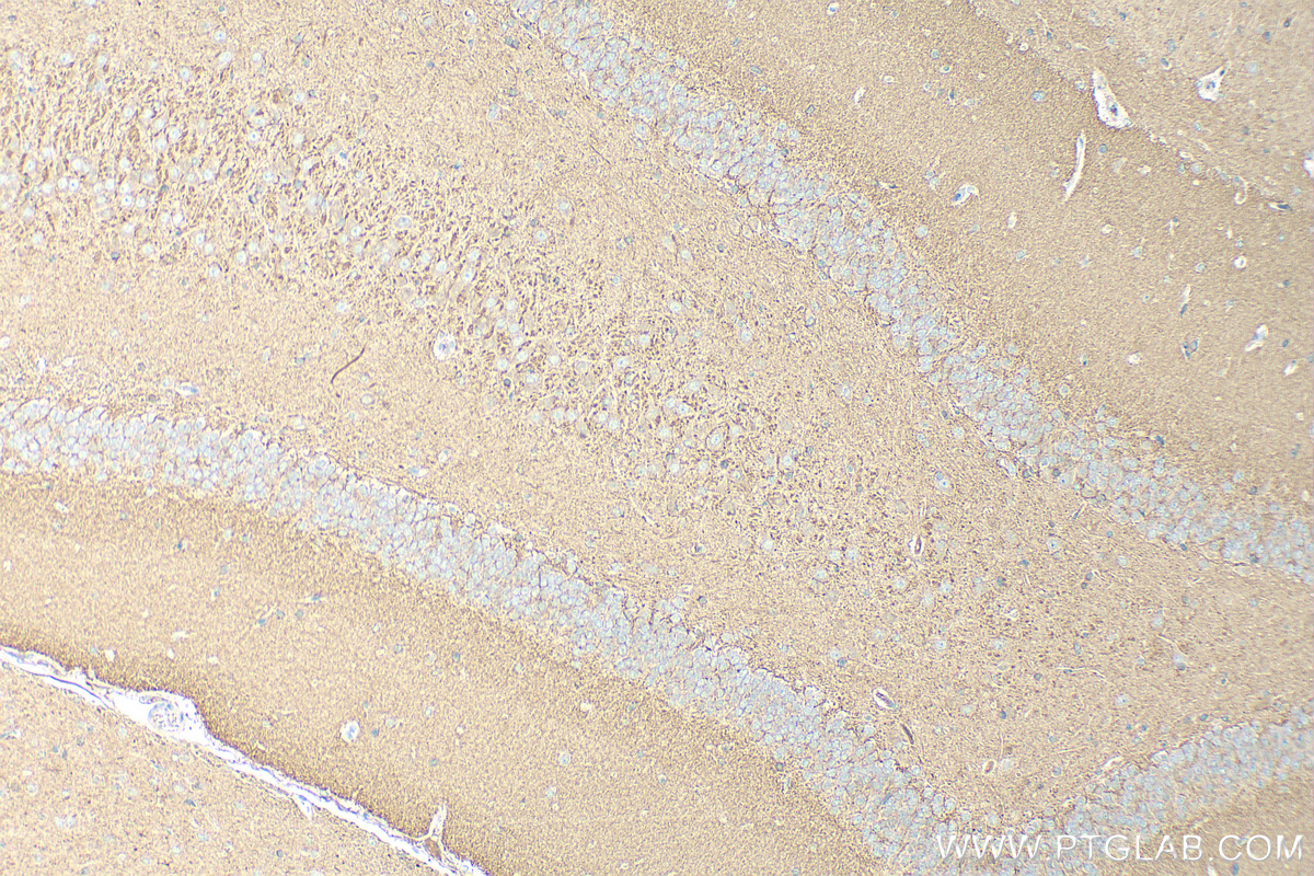 Immunohistochemical analysis of paraffin-embedded rat brain tissue slide using 15774-1-AP (RAB3B/C antibody) at dilution of 1:200 (under 10x lens). Heat mediated antigen retrieval with Tris-EDTA buffer (pH 9.0). IHC staining of rat brain using 15774-1-AP