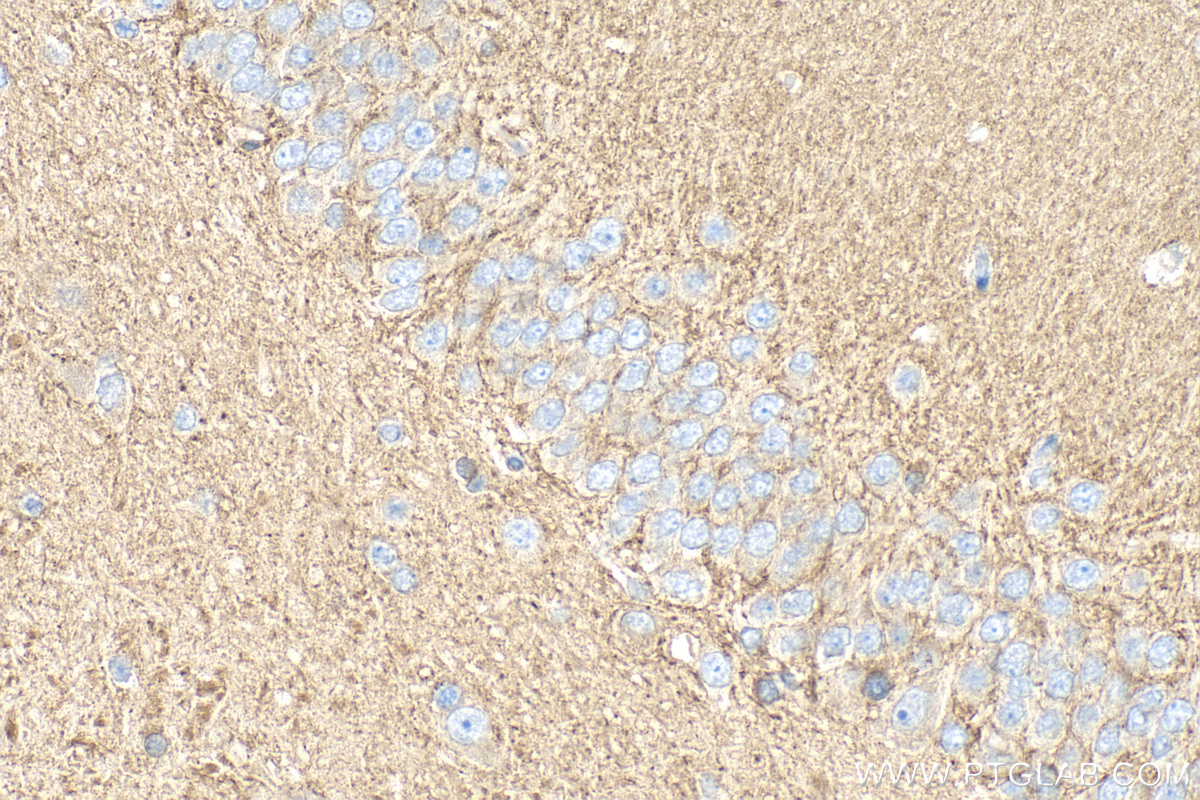 Immunohistochemical analysis of paraffin-embedded rat brain tissue slide using 15774-1-AP (RAB3B/C antibody) at dilution of 1:200 (under 40x lens). Heat mediated antigen retrieval with Tris-EDTA buffer (pH 9.0). IHC staining of rat brain using 15774-1-AP