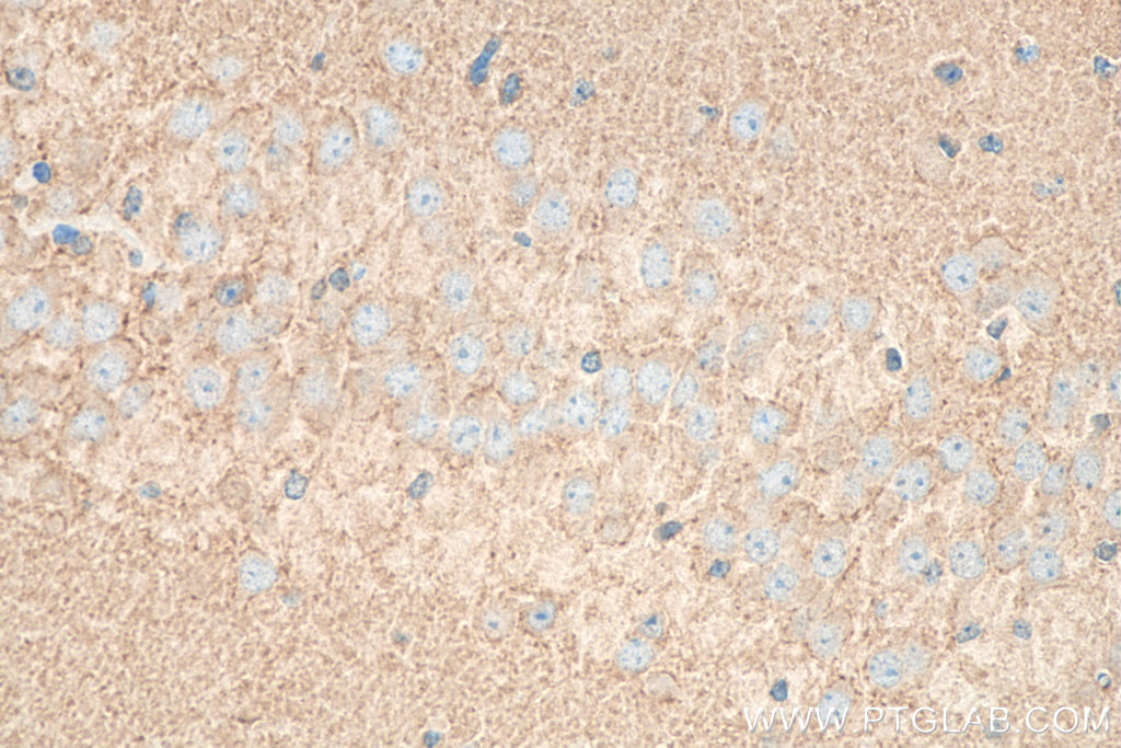 IHC staining of mouse brain using 10788-1-AP