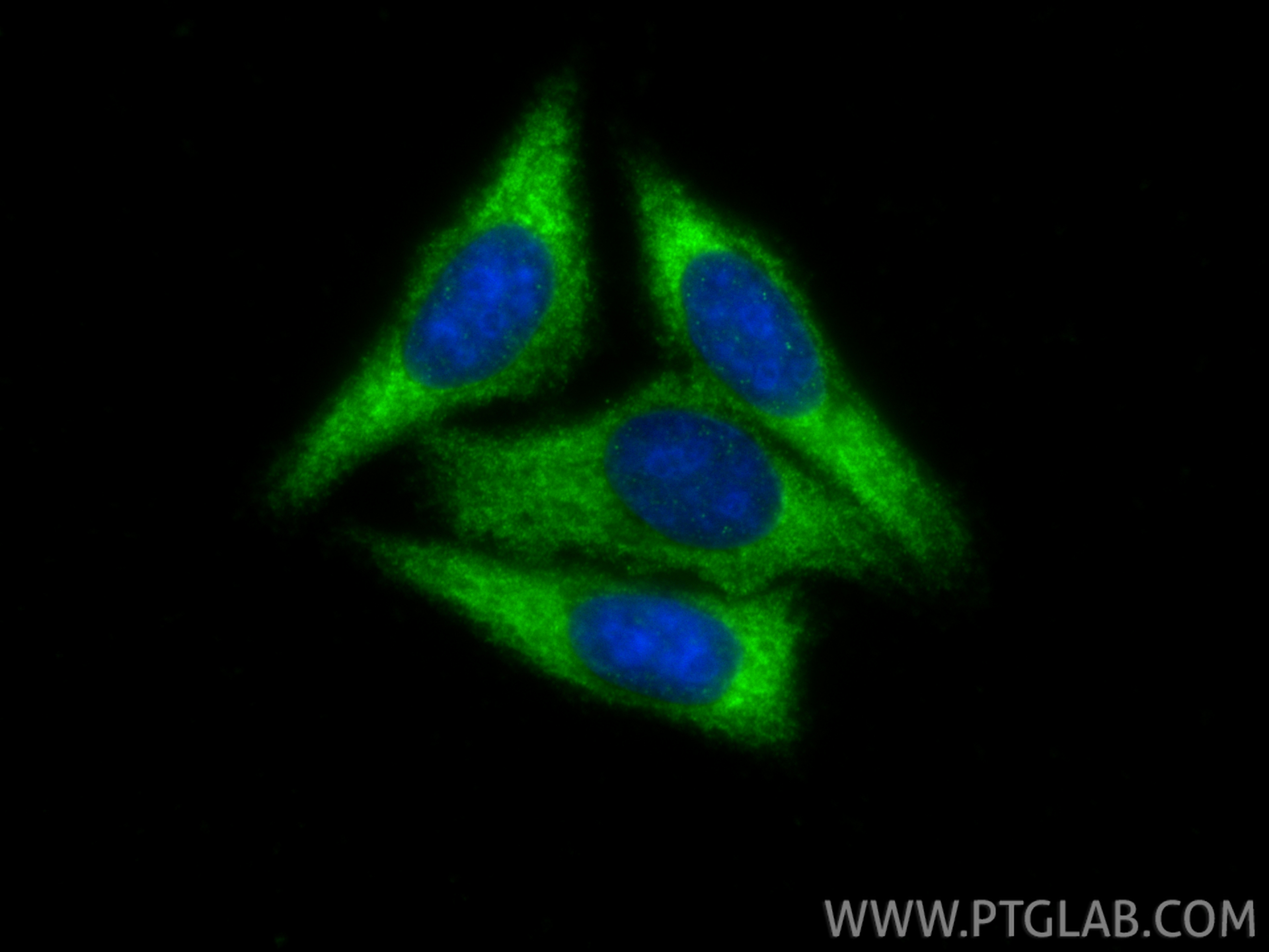 IF Staining of HepG2 using 16867-1-AP IF Staining of HepG2 using 16867-1-AP