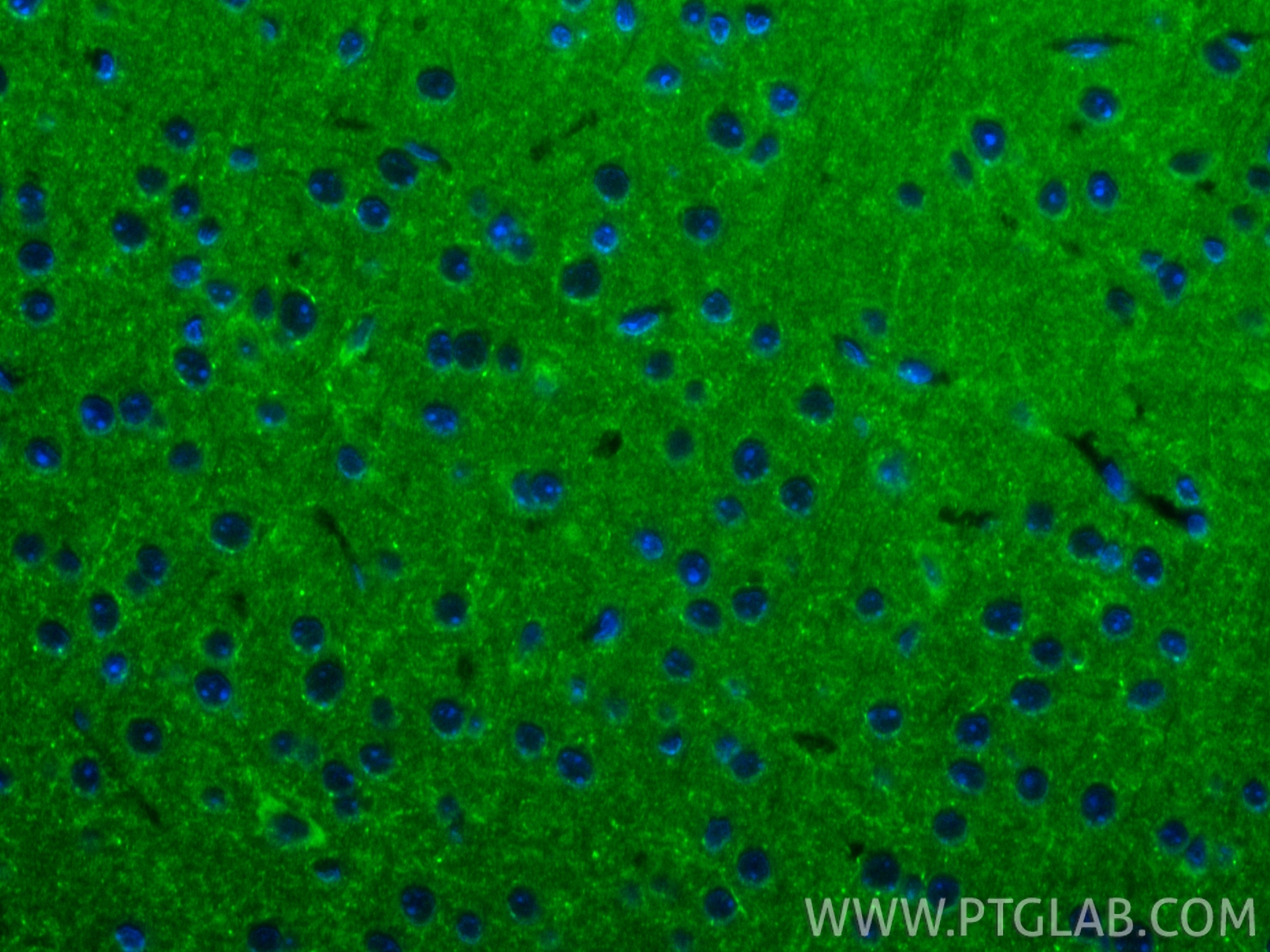 IF Staining of mouse brain using 16867-1-AP IF Staining of mouse brain using 16867-1-AP