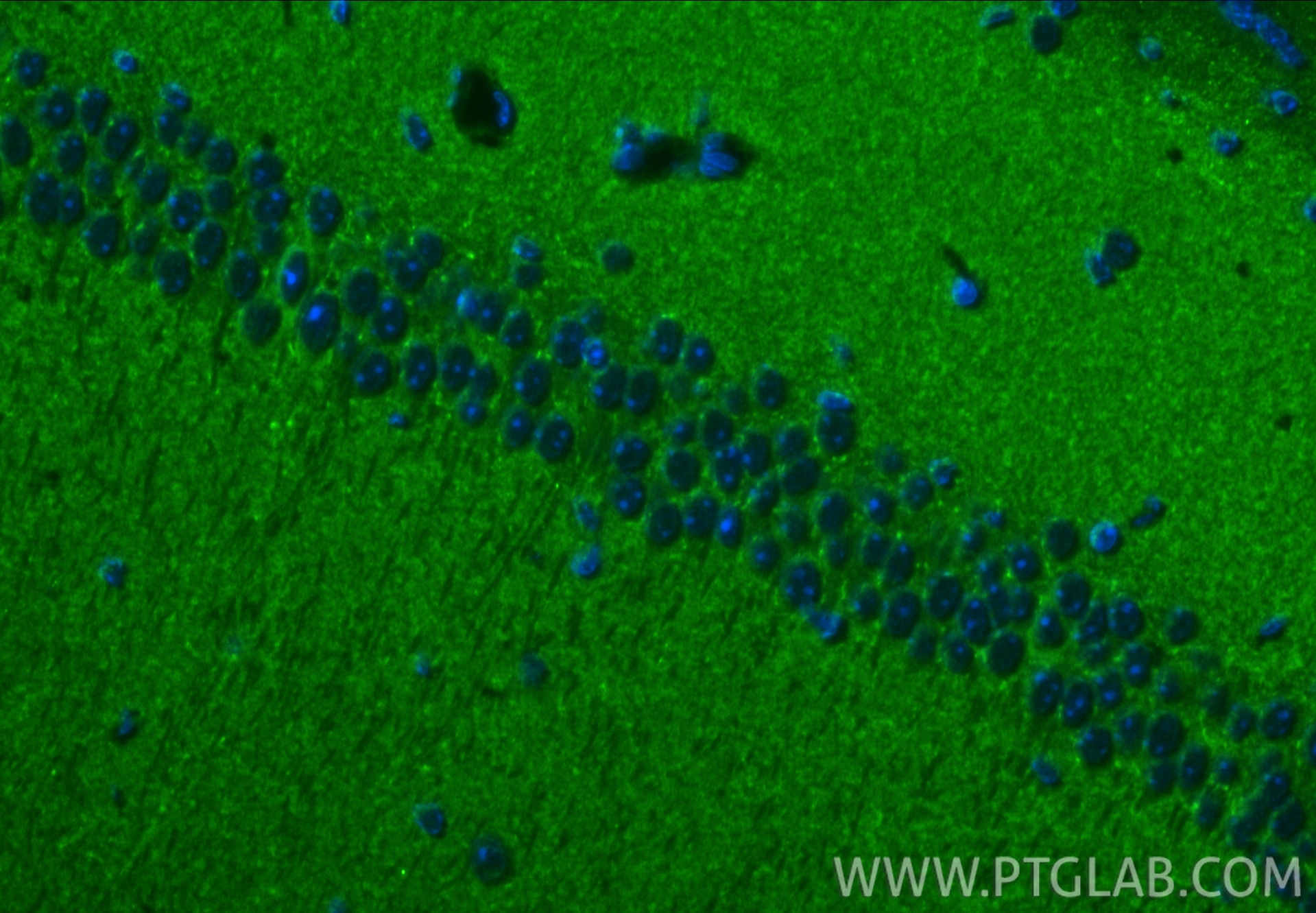 IF Staining of mouse brain using 16867-1-AP IF Staining of mouse brain using 16867-1-AP
