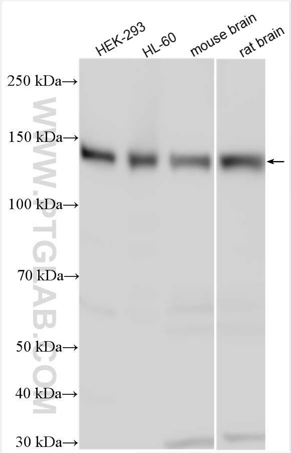 WB analysis using 21663-1-AP