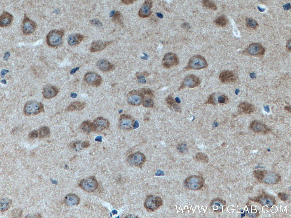 IHC staining of mouse brain using 66688-1-Ig (same clone as 66688-1-PBS)