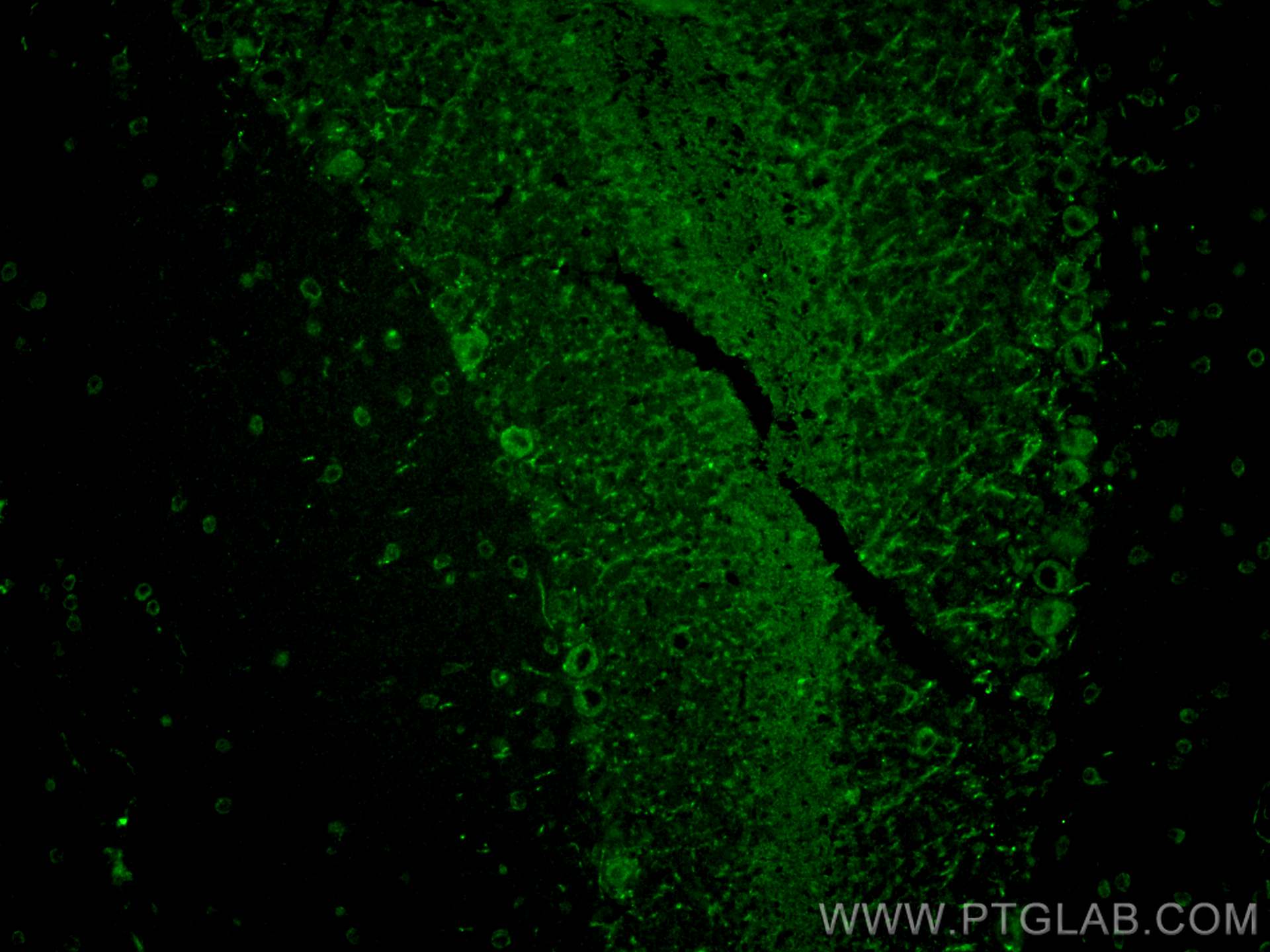 Immunofluorescent analysis of (4% PFA) fixed paraffin-embedded mouse cerebellum tissue using RAB3IL1 antibody (17827-1-AP) at dilution of 1:200 and CoraLite®488-Conjugated AffiniPure Goat Anti-Rabbit IgG(H+L) (<a class='green' href='/productredirect?CatalogNo=SA00013-2' target='_blank'>SA00013-2</a>). Heat mediated antigen retrieval with Tris-EDTA buffer (pH 9.0). IF Staining of mouse cerebellum using 17827-1-AP