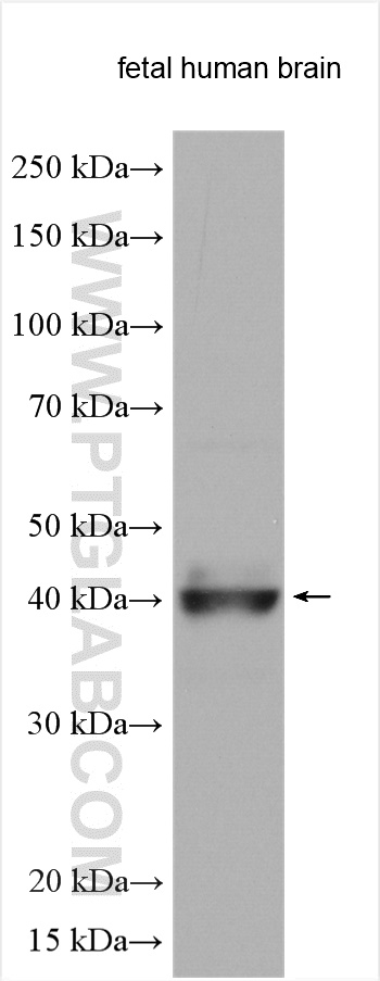 WB analysis using 17827-1-AP