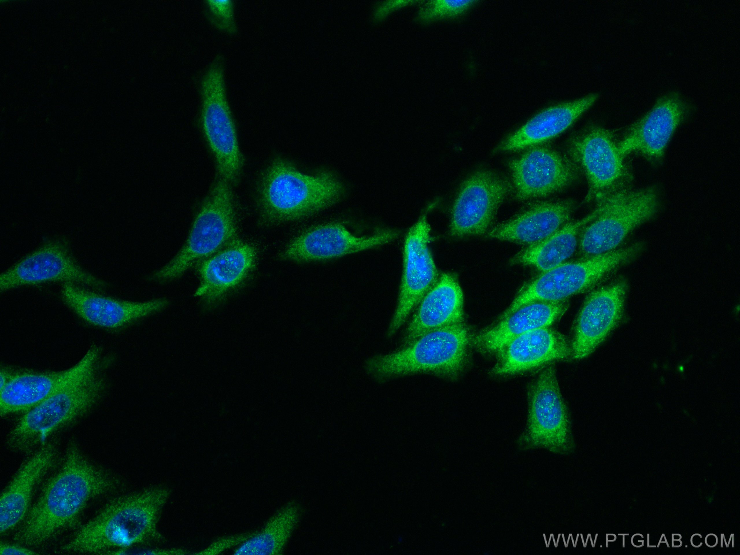 IF Staining of HepG2 using 12321-1-AP