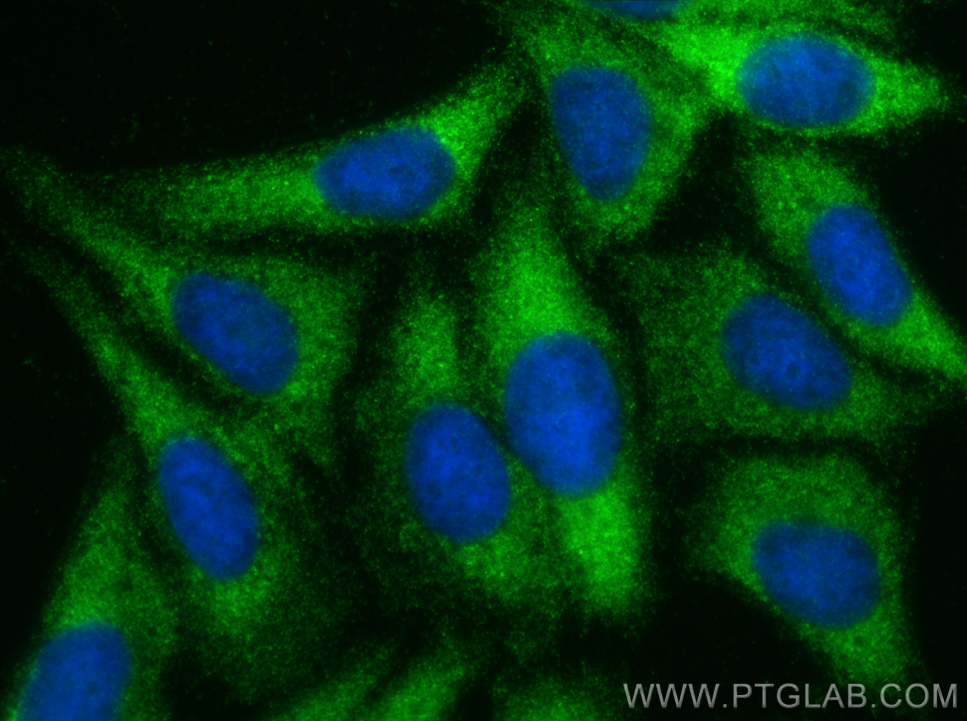 IF Staining of HepG2 using 12321-1-AP