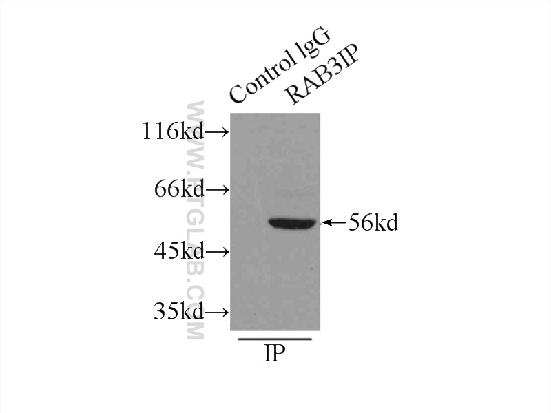 IP experiment of mouse lung using 12321-1-AP