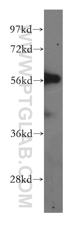 RAB3IP Polyclonal antibody