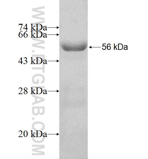 RABIN8 fusion protein Ag2974 SDS-PAGE