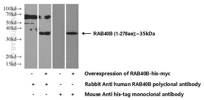 RAB40B