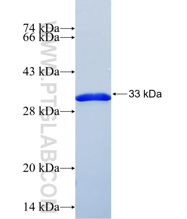 RAB41 fusion protein Ag37990 SDS-PAGE RAB41 fusion protein Ag37990 SDS-PAGE