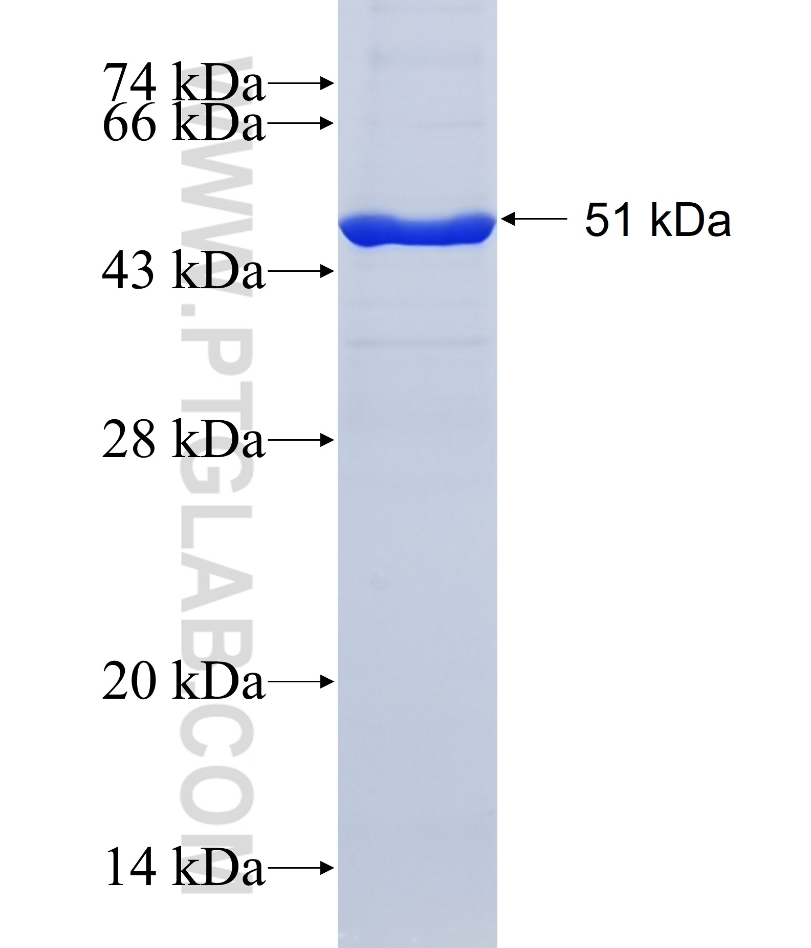 RAB42 fusion protein Ag38592 SDS-PAGE RAB42 fusion protein Ag38592 SDS-PAGE