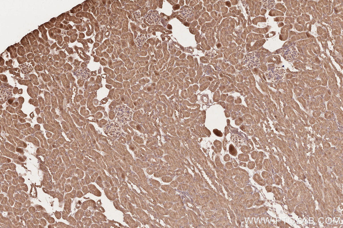 IHC staining of mouse kidney using 28240-1-AP IHC staining of mouse kidney using 28240-1-AP