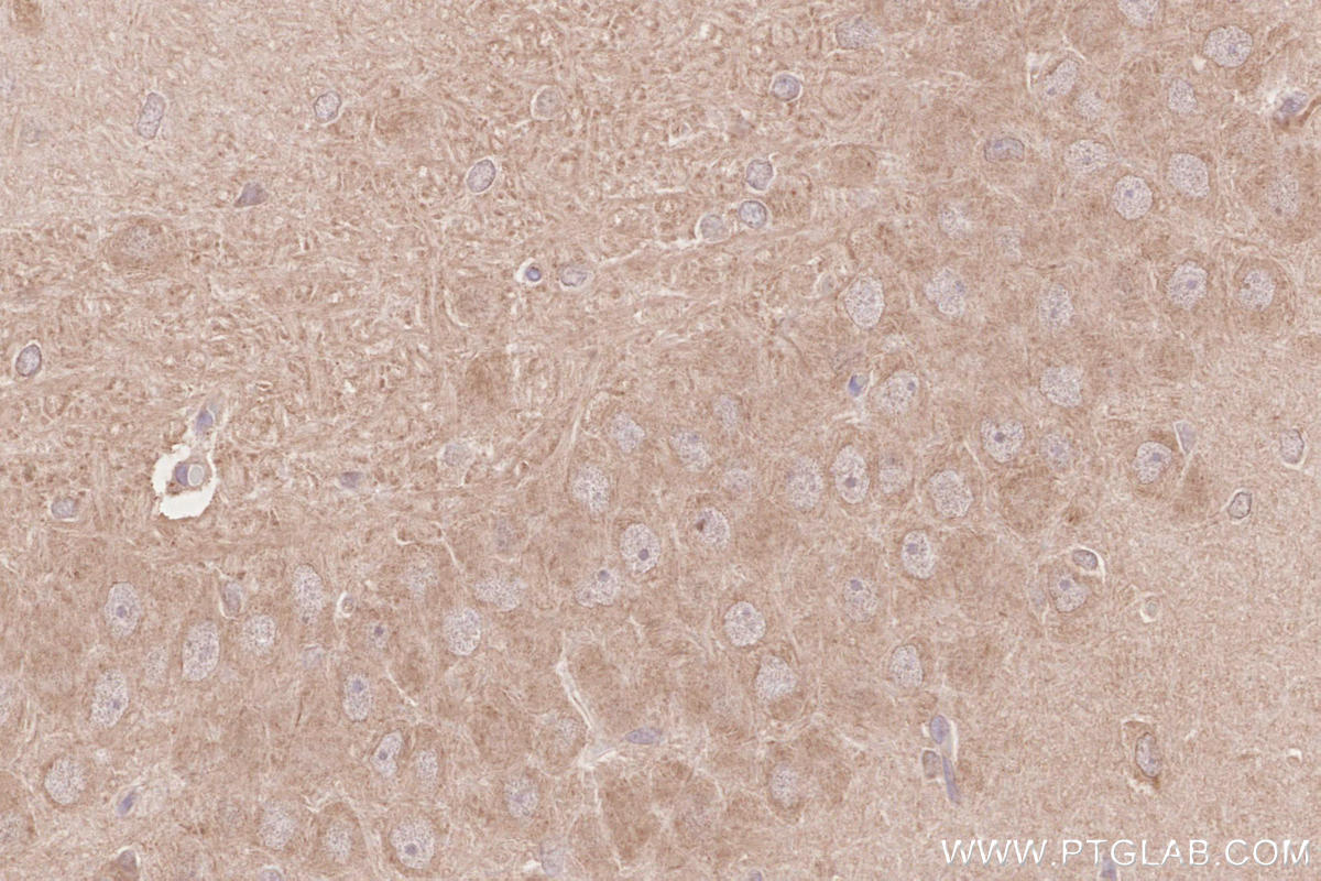 IHC staining of rat brain using 28240-1-AP