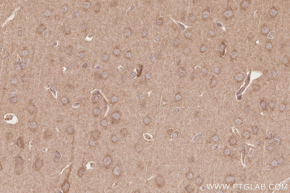 IHC staining of rat brain using 28240-1-AP