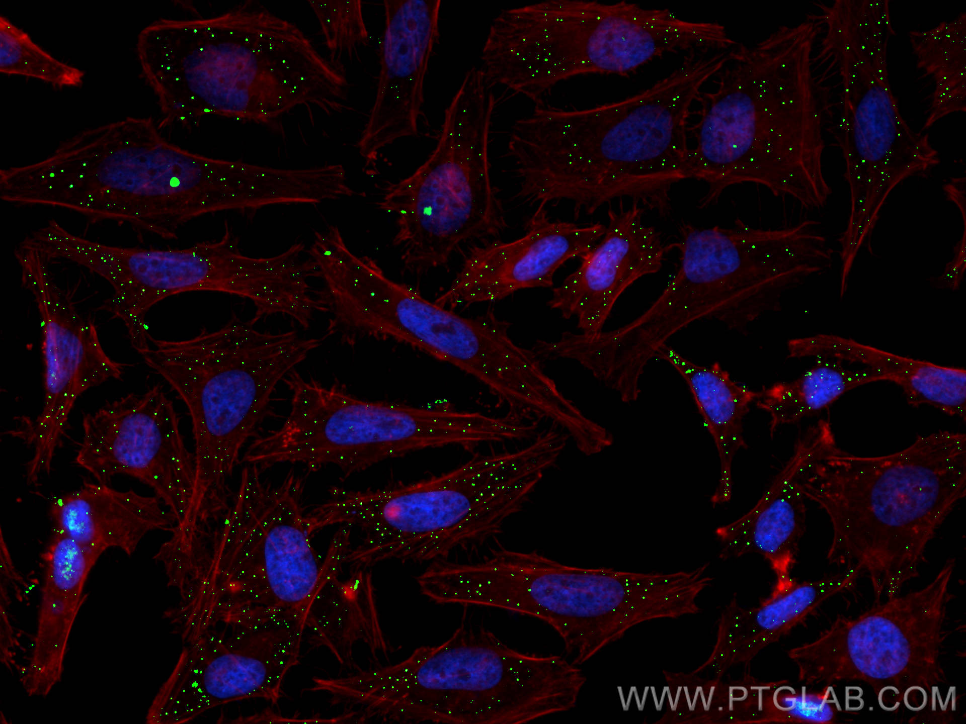 IF Staining of HeLa using 10347-1-AP