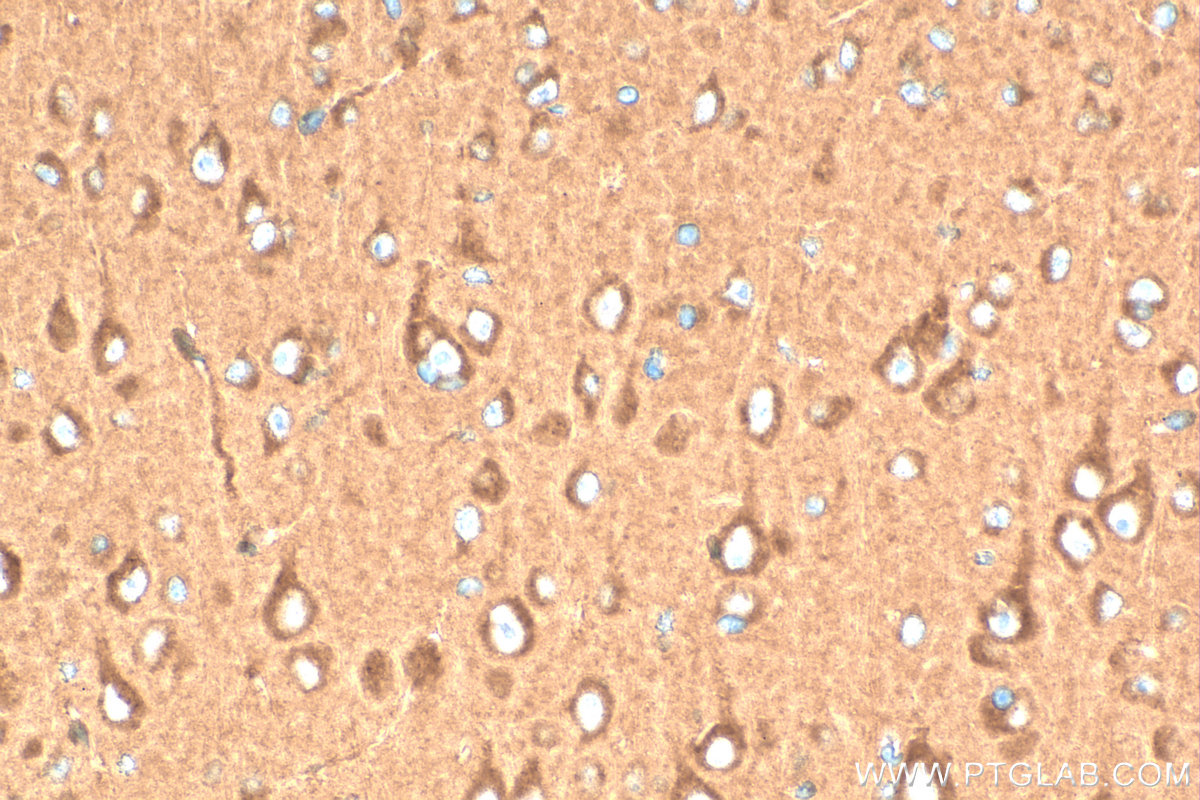 IHC staining of mouse brain using 10347-1-AP