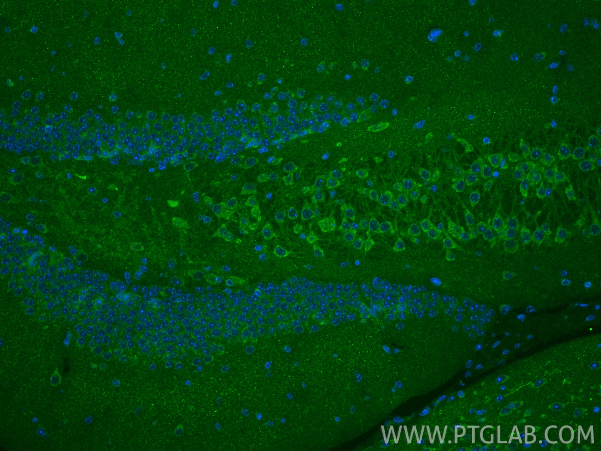 IF Staining of mouse brain using 11947-1-AP IF Staining of mouse brain using 11947-1-AP