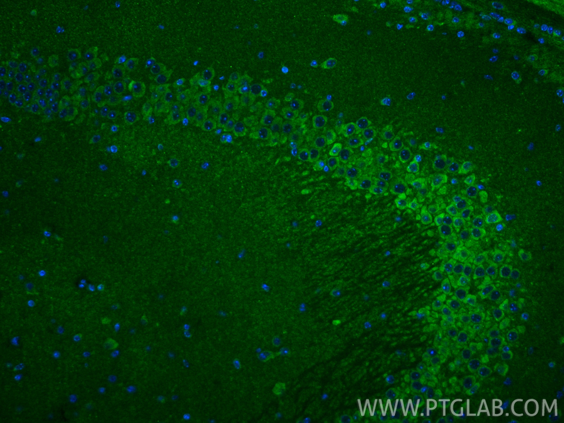 IF Staining of mouse brain using 11947-1-AP IF Staining of mouse brain using 11947-1-AP