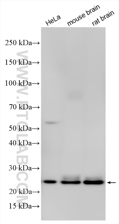 WB analysis using 11947-1-AP
