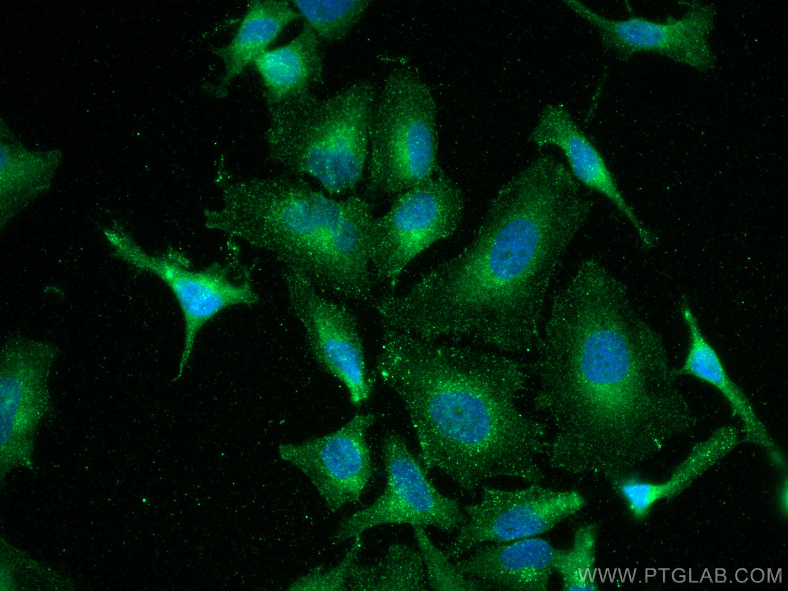 IF Staining of HeLa using 66339-1-Ig (same clone as 66339-1-PBS)