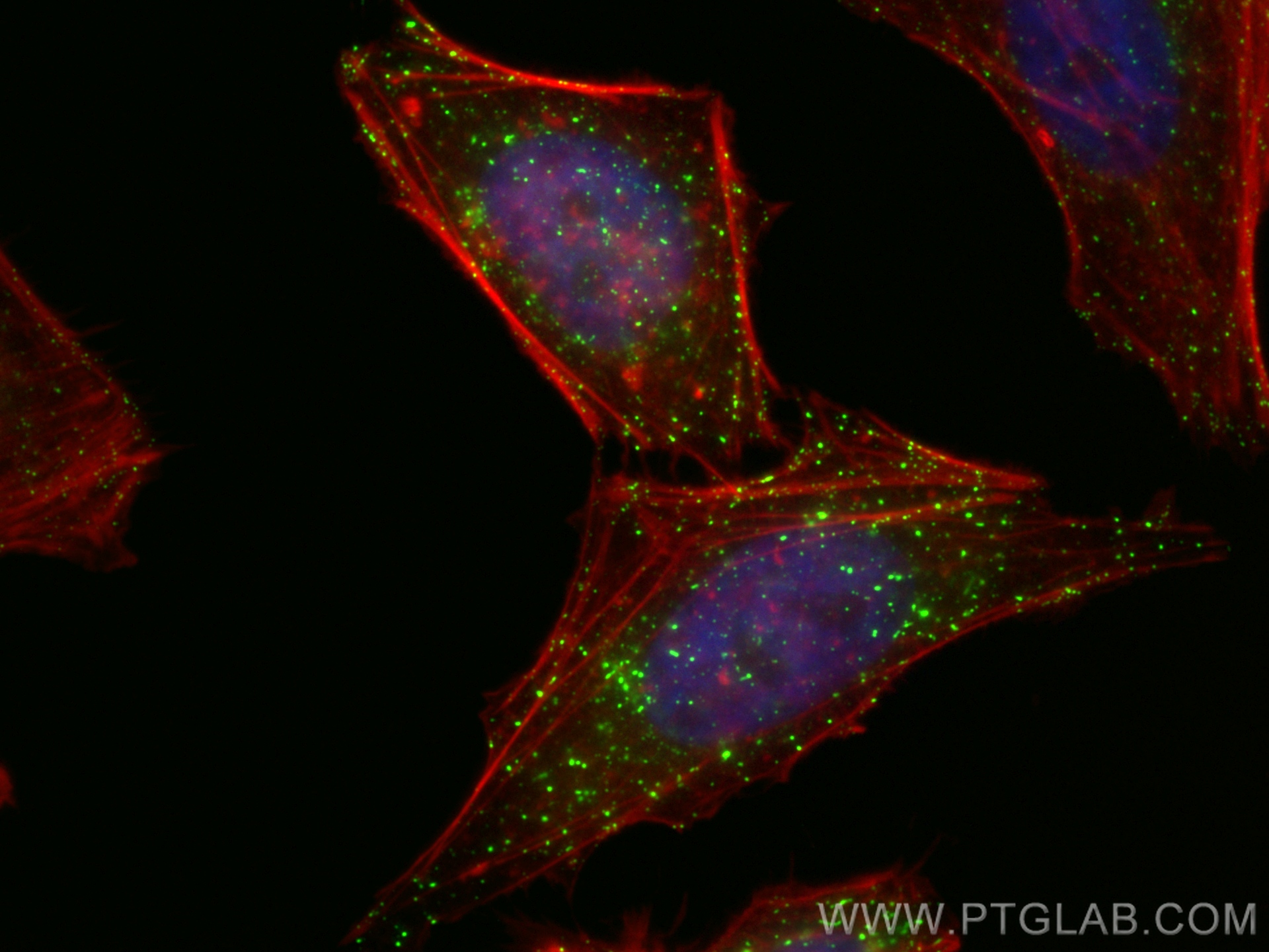 IF Staining of HeLa using 66339-1-Ig