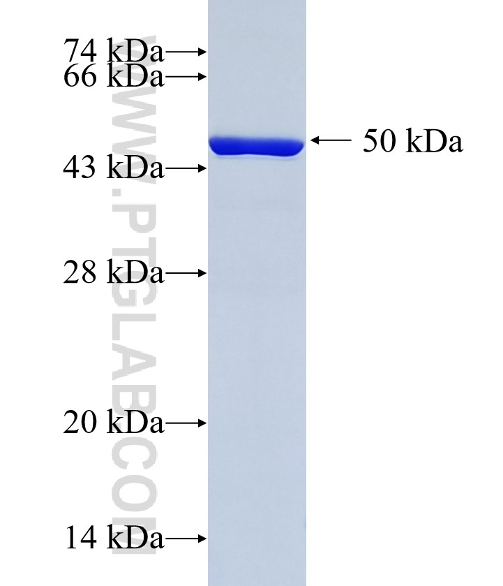 RAB5A fusion protein Ag2549 SDS-PAGE