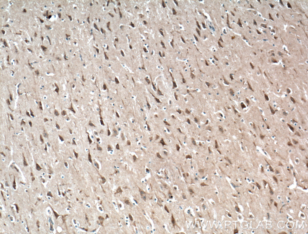 IHC staining of human brain using 20228-1-AP