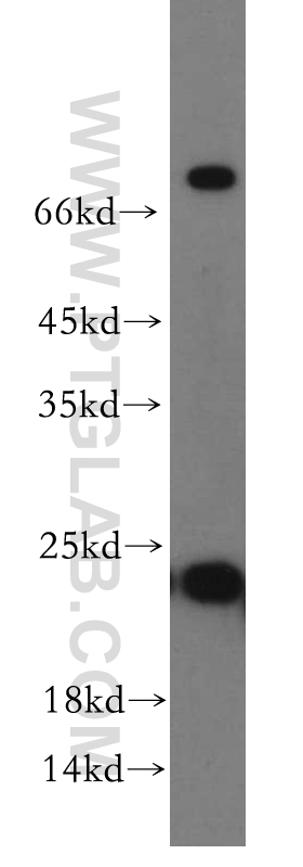 RAB5A-Specific Polyclonal antibody