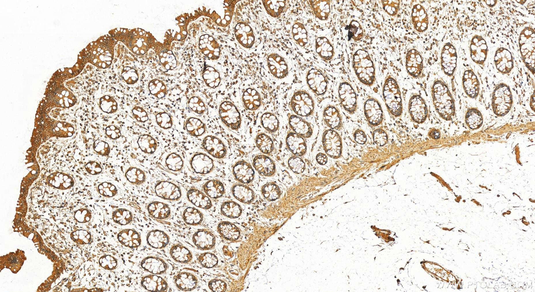 IHC staining of human colon using 27403-1-AP