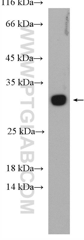 WB analysis of mouse lung using 27403-1-AP