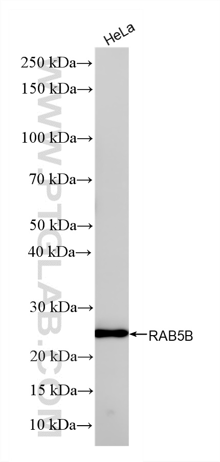 WB analysis using 86951-1-RR WB analysis using 86951-1-RR