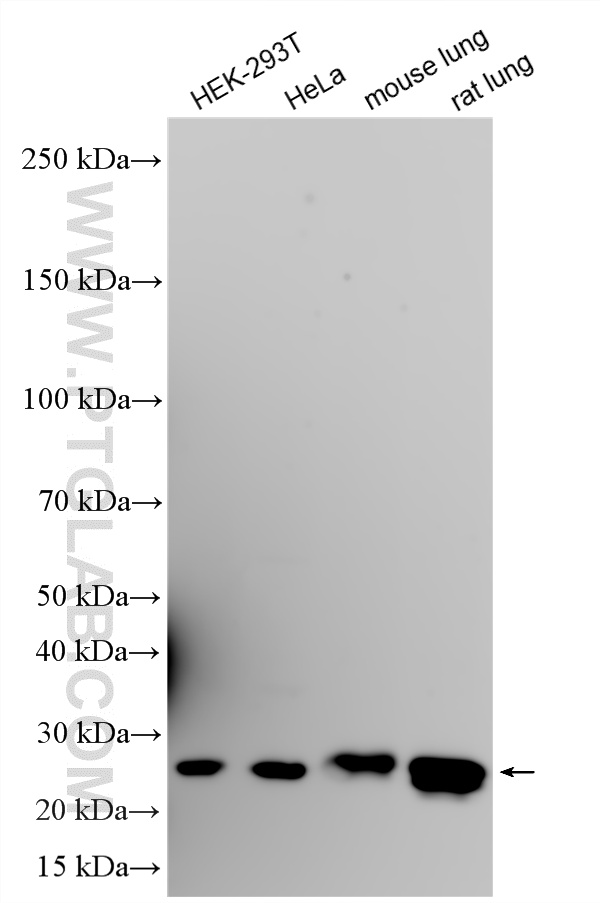 WB analysis using 86951-1-RR WB analysis using 86951-1-RR