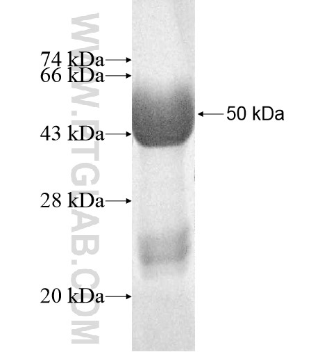 RAB5B fusion protein Ag11722 SDS-PAGE