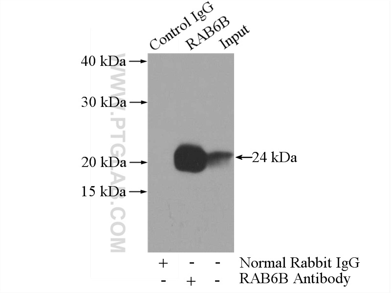 IP experiment of mouse brain using 10340-1-AP