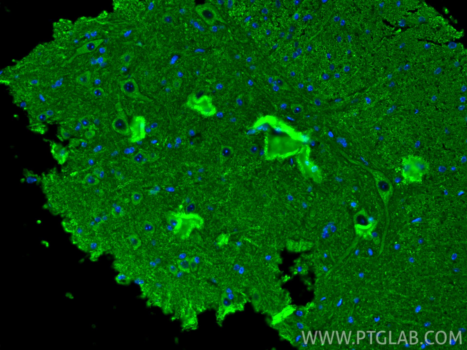 IF Staining of mouse spinal cord using 55469-1-AP IF Staining of mouse spinal cord using 55469-1-AP