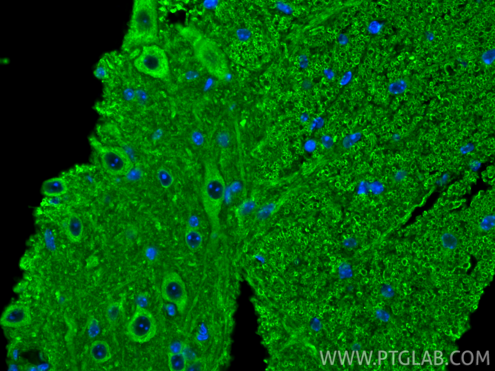 IF Staining of mouse spinal cord using 55469-1-AP IF Staining of mouse spinal cord using 55469-1-AP
