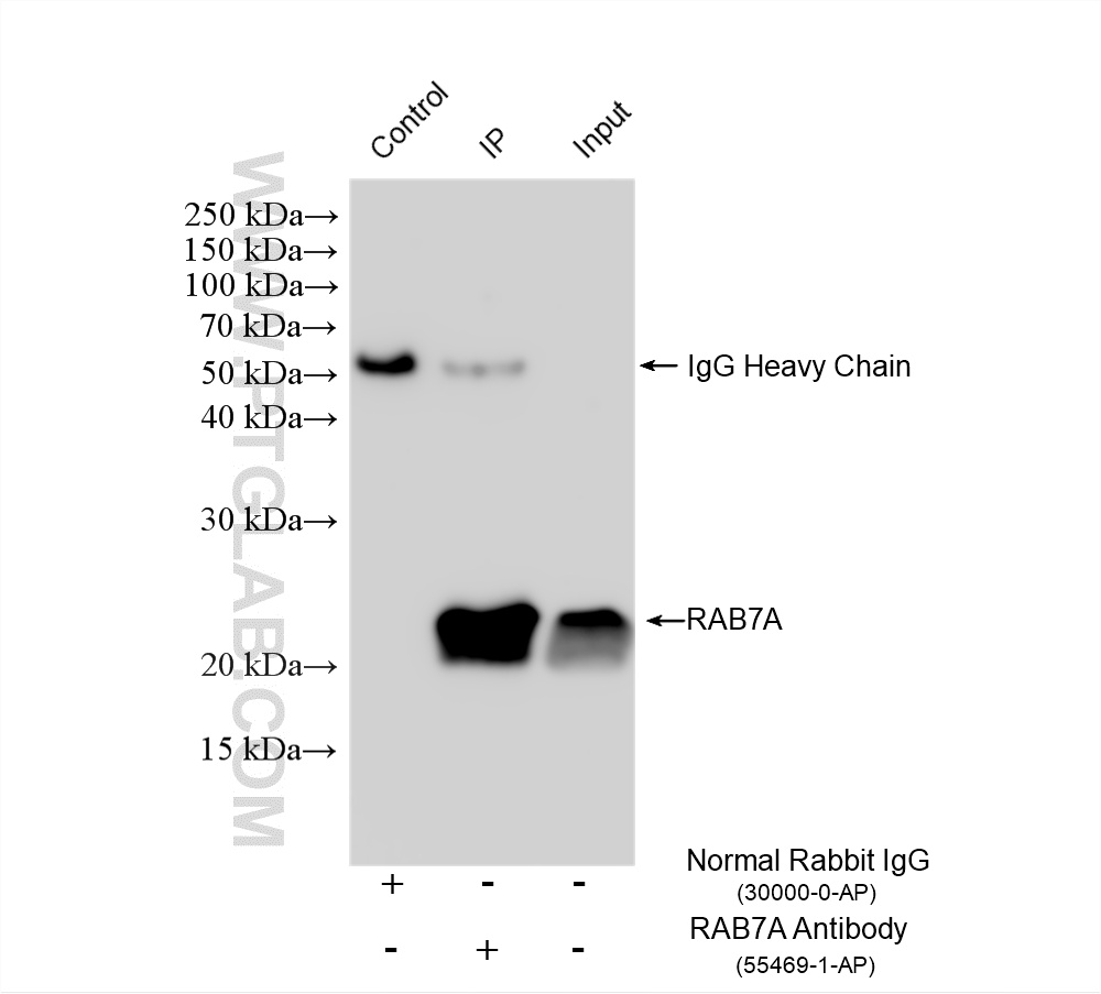 IP experiment of A431 using 55469-1-AP