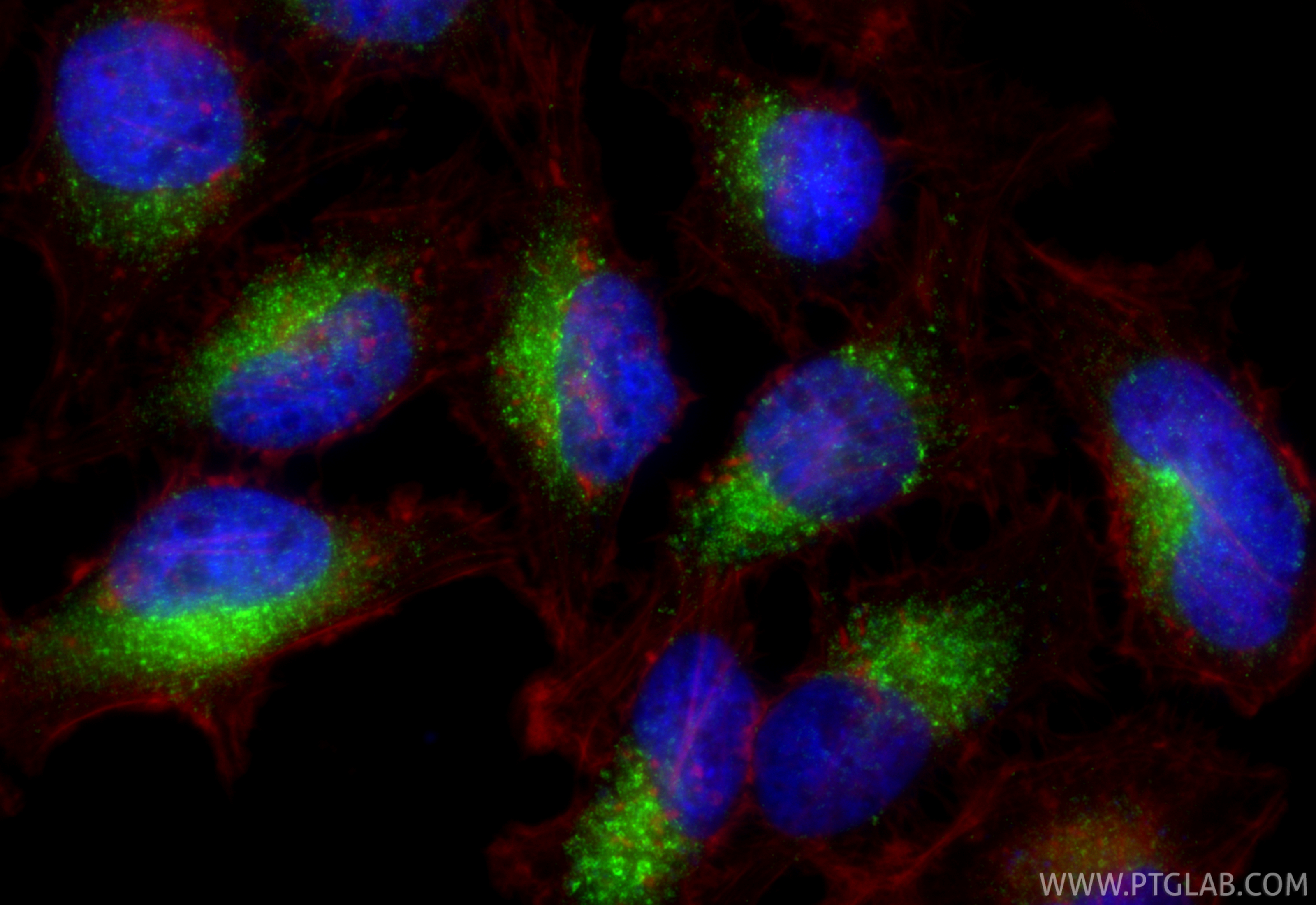 IF Staining of HeLa using RMX00029