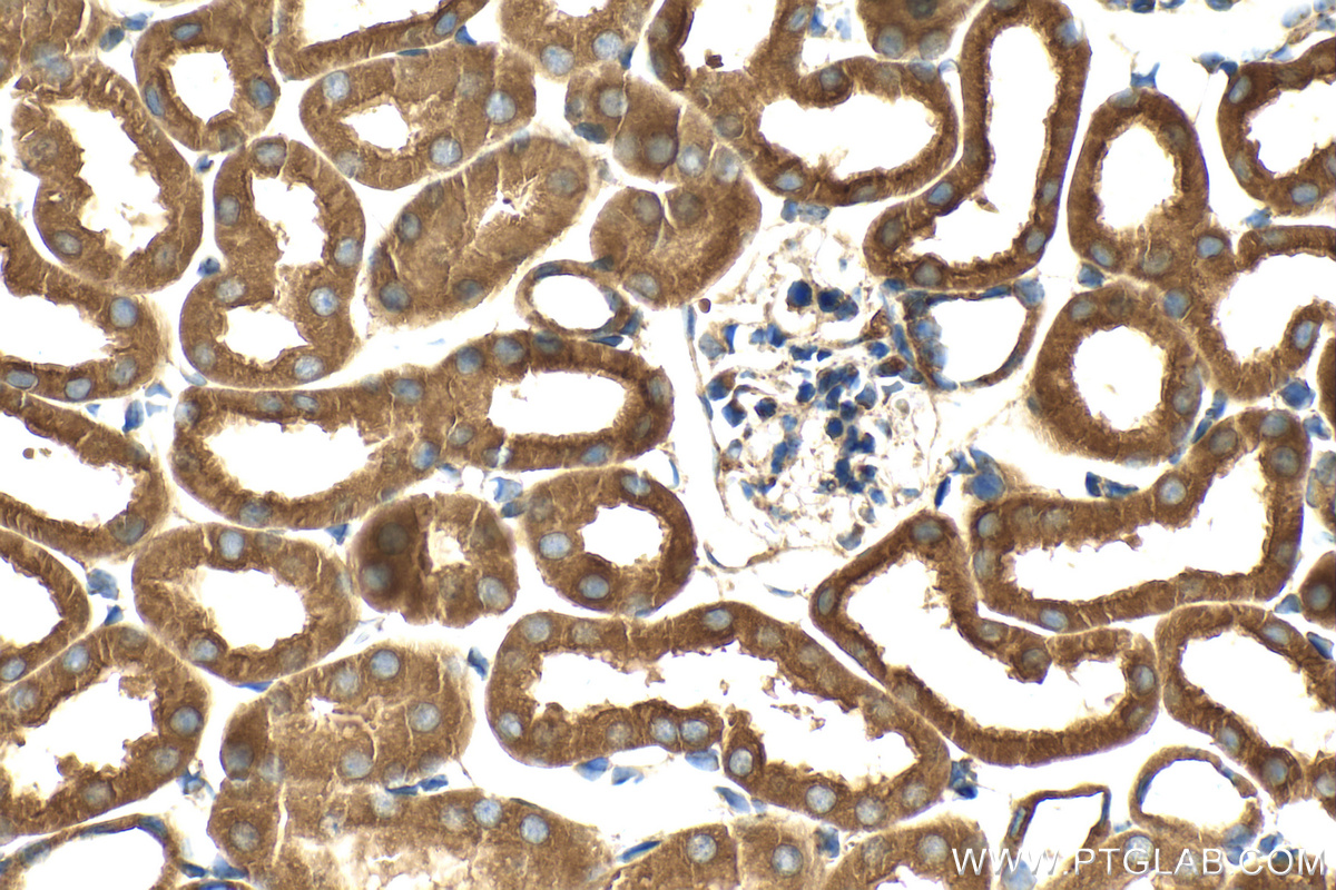 IHC staining of mouse kidney using RMX00029