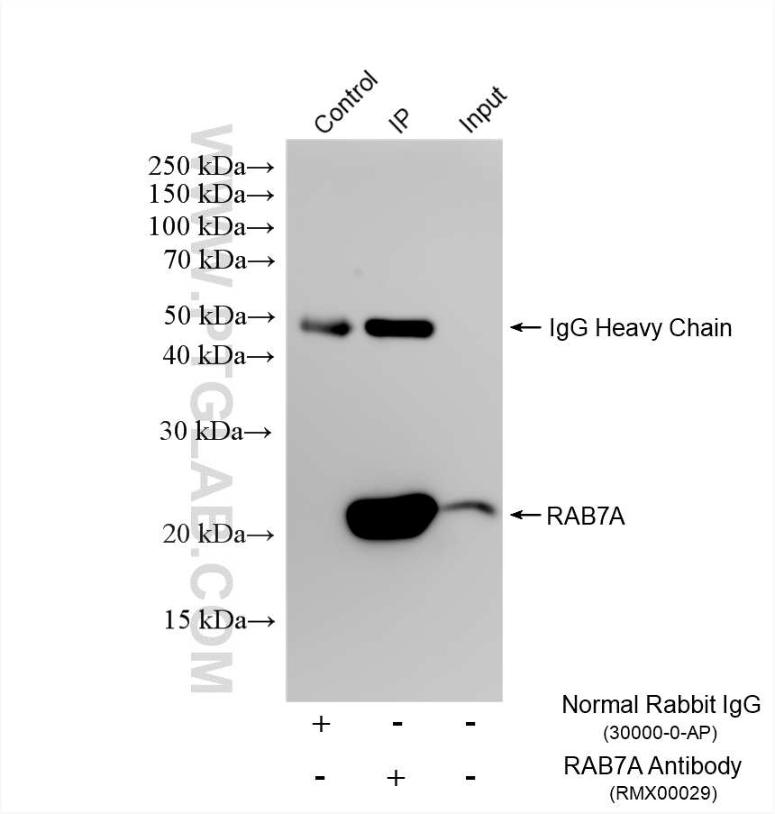 IP experiment of mouse brain using RMX00029