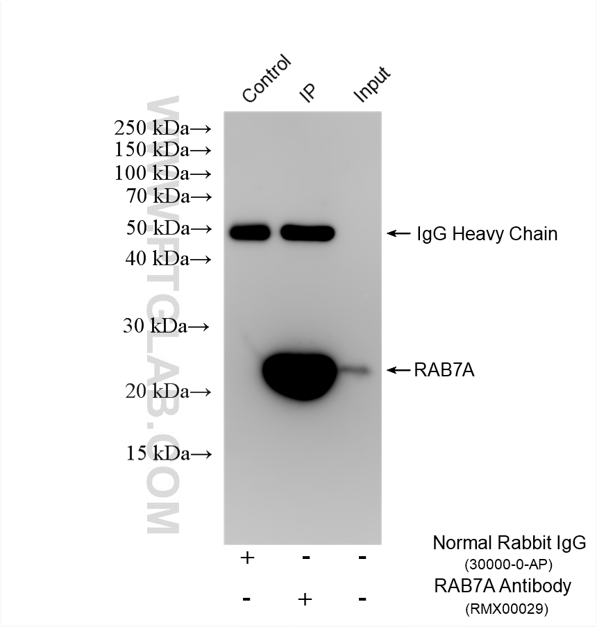 IP experiment of SH-SY5Y using RMX00029