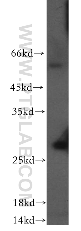 RAB7B Polyclonal antibody