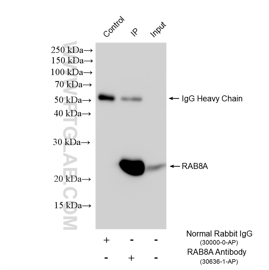 IP experiment of HeLa using 30636-1-AP