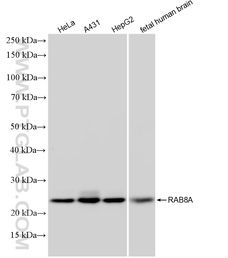 WB analysis using 86540-5-RR (same clone as 86540-5-PBS) WB analysis using 86540-5-RR (same clone as 86540-5-PBS)