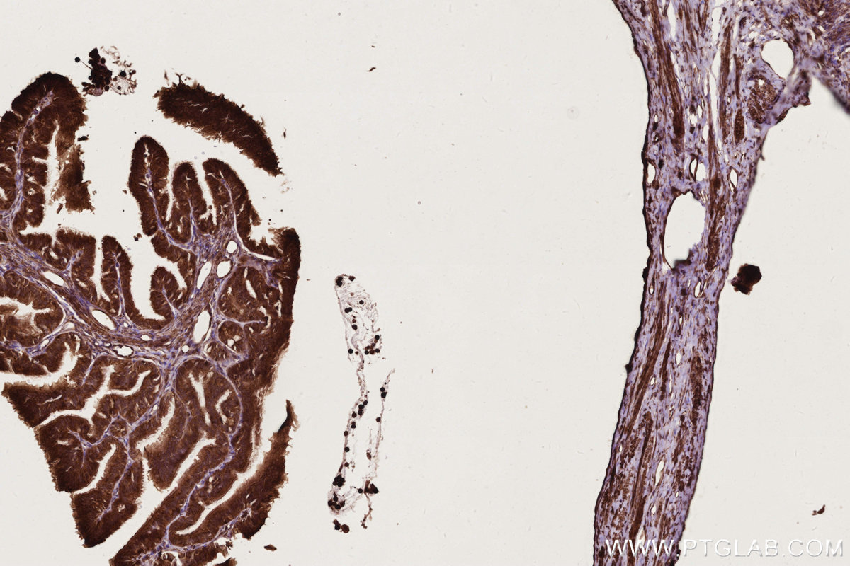 IHC staining of rat ovary using 11792-1-AP IHC staining of rat ovary using 11792-1-AP