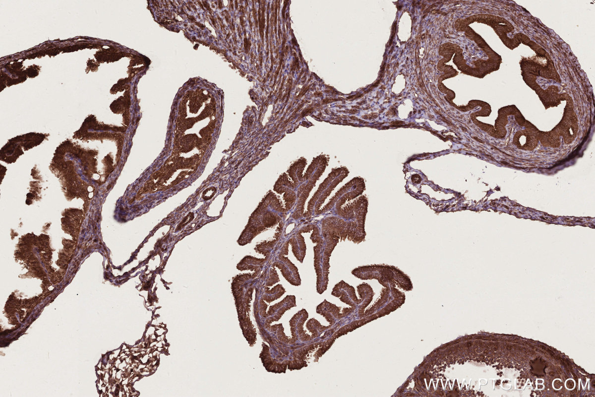 IHC staining of mouse ovary using 11792-1-AP IHC staining of mouse ovary using 11792-1-AP