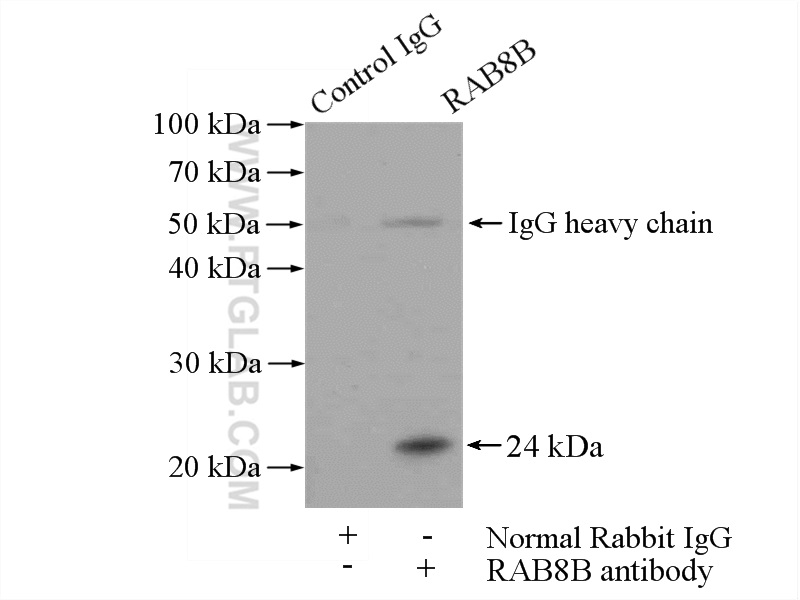 IP experiment of mouse brain using 11792-1-AP